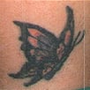 Tattoo Removal - Before