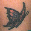 tattoo-removal-before